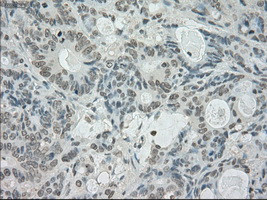 SATB1 Antibody in Immunohistochemistry (Paraffin) (IHC (P))