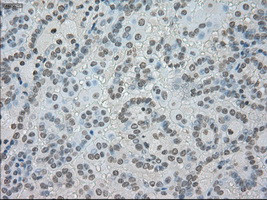 SATB1 Antibody in Immunohistochemistry (Paraffin) (IHC (P))