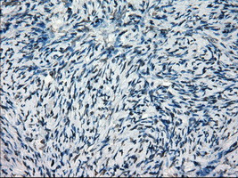 SATB1 Antibody in Immunohistochemistry (Paraffin) (IHC (P))