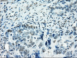 SATB1 Antibody in Immunohistochemistry (Paraffin) (IHC (P))