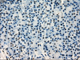 SATB1 Antibody in Immunohistochemistry (Paraffin) (IHC (P))