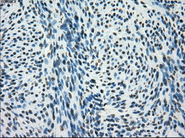 SATB1 Antibody in Immunohistochemistry (Paraffin) (IHC (P))