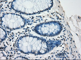 SATB1 Antibody in Immunohistochemistry (Paraffin) (IHC (P))