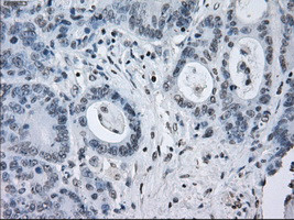 SATB1 Antibody in Immunohistochemistry (Paraffin) (IHC (P))