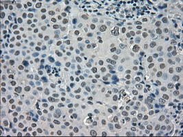 SATB1 Antibody in Immunohistochemistry (Paraffin) (IHC (P))