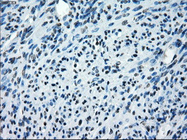 SATB1 Antibody in Immunohistochemistry (Paraffin) (IHC (P))