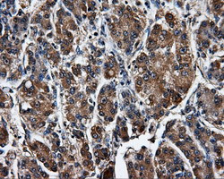 SATB1 Antibody in Immunohistochemistry (Paraffin) (IHC (P))