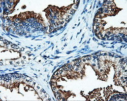 SATB1 Antibody in Immunohistochemistry (Paraffin) (IHC (P))