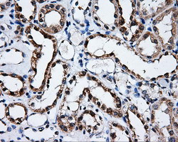 SATB1 Antibody in Immunohistochemistry (Paraffin) (IHC (P))