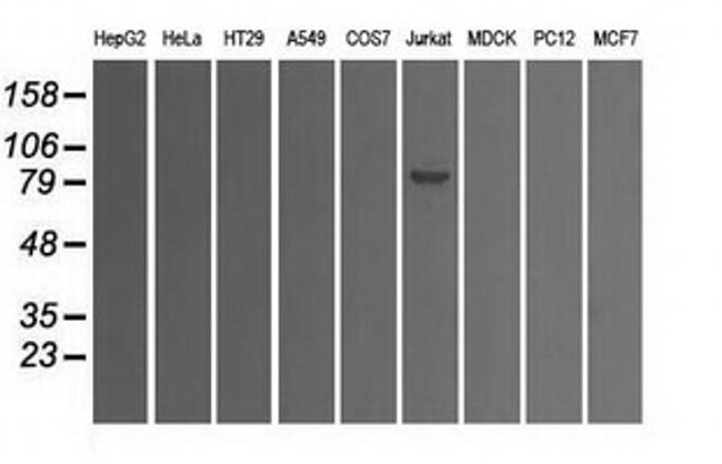 SATB1 Antibody in Western Blot (WB)