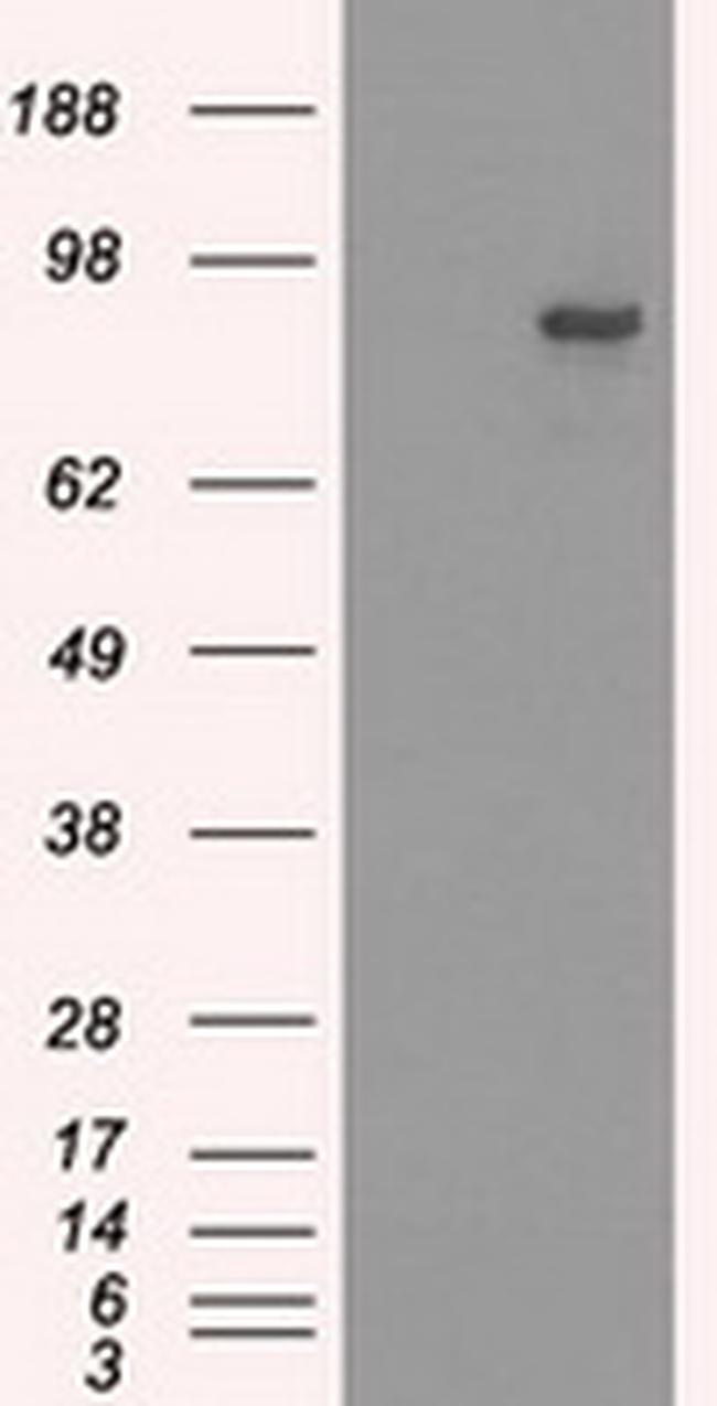 SATB1 Antibody in Western Blot (WB)