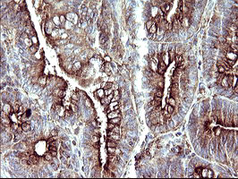 SCAMP2 Antibody in Immunohistochemistry (Paraffin) (IHC (P))