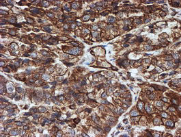 SCFD1 Antibody in Immunohistochemistry (Paraffin) (IHC (P))