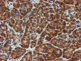 SCFD1 Antibody in Immunohistochemistry (Paraffin) (IHC (P))