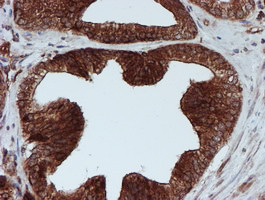 SCFD1 Antibody in Immunohistochemistry (Paraffin) (IHC (P))