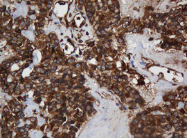 SCFD1 Antibody in Immunohistochemistry (Paraffin) (IHC (P))