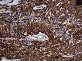 SCFD1 Antibody in Immunohistochemistry (Paraffin) (IHC (P))