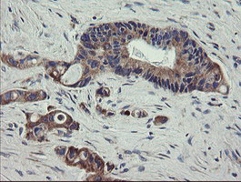 SCFD1 Antibody in Immunohistochemistry (Paraffin) (IHC (P))