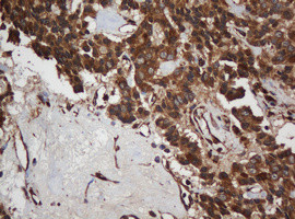 SCFD1 Antibody in Immunohistochemistry (Paraffin) (IHC (P))