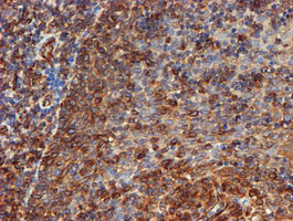 SCFD1 Antibody in Immunohistochemistry (Paraffin) (IHC (P))