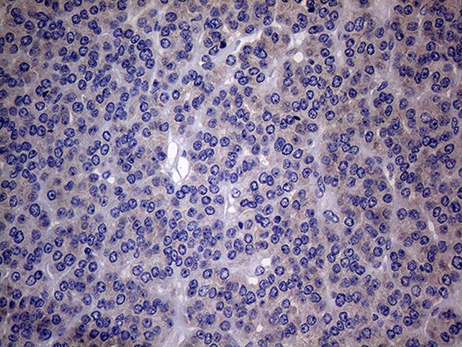 SCFD1 Antibody in Immunohistochemistry (Paraffin) (IHC (P))