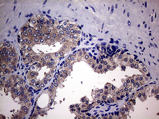 SCFD1 Antibody in Immunohistochemistry (Paraffin) (IHC (P))