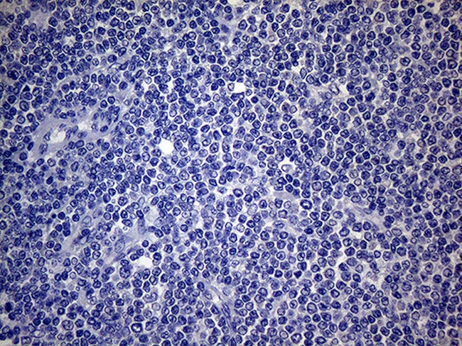 SCFD1 Antibody in Immunohistochemistry (Paraffin) (IHC (P))