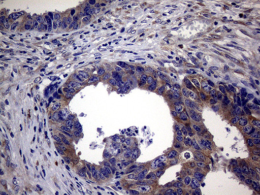 SCFD1 Antibody in Immunohistochemistry (Paraffin) (IHC (P))