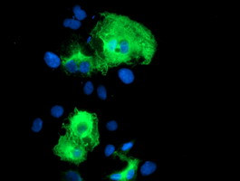 SCHIP1 Antibody in Immunocytochemistry (ICC/IF)