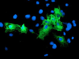 SCHIP1 Antibody in Immunocytochemistry (ICC/IF)