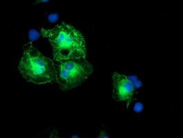 SCHIP1 Antibody in Immunocytochemistry (ICC/IF)