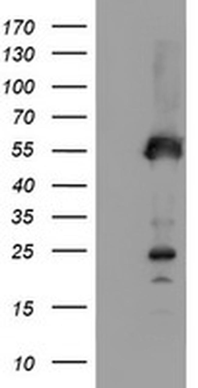 SCHIP1 Antibody in Western Blot (WB)