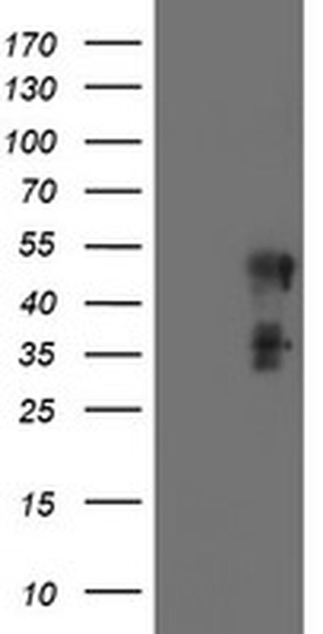 SCHIP1 Antibody in Western Blot (WB)