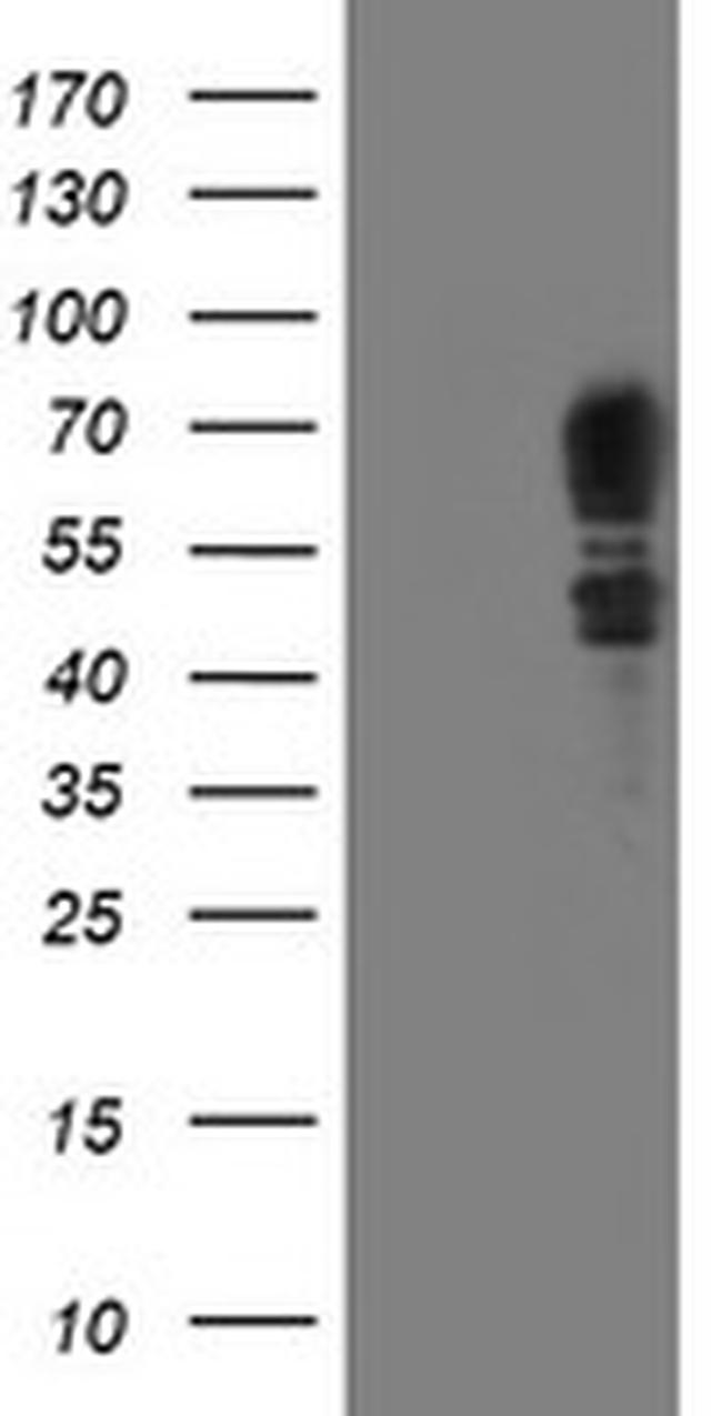 SCHIP1 Antibody in Western Blot (WB)