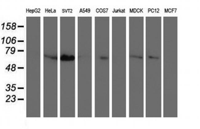 SCHIP1 Antibody in Western Blot (WB)