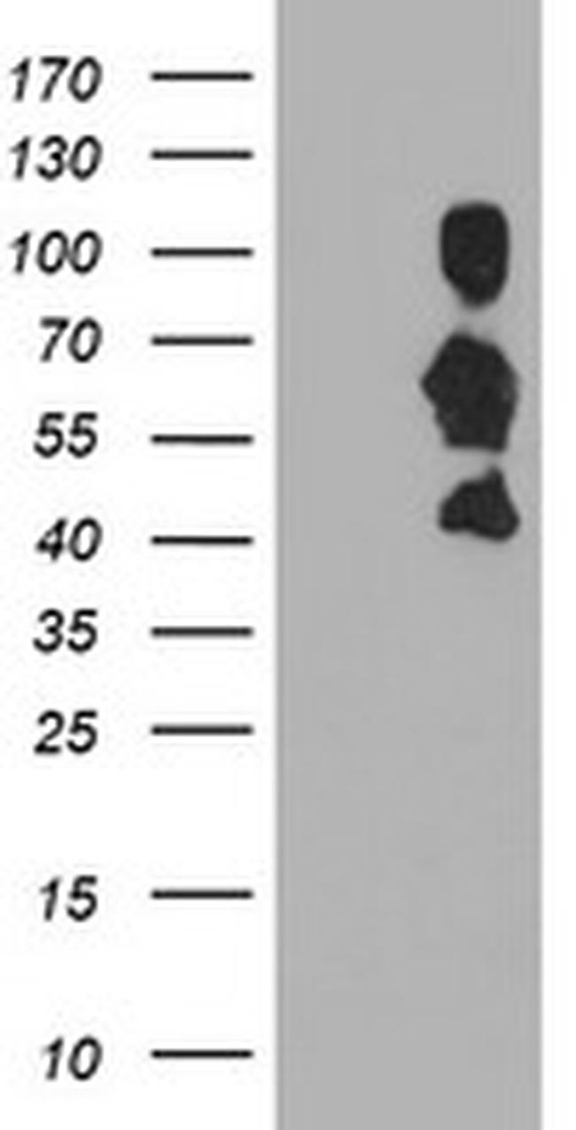 SCHIP1 Antibody in Western Blot (WB)