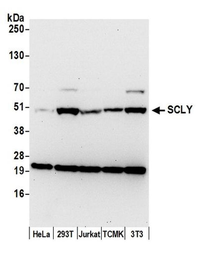 SCLY Antibody in Western Blot (WB)