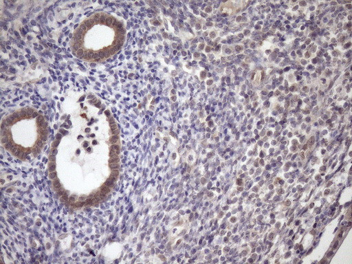 SCMH1 Antibody in Immunohistochemistry (Paraffin) (IHC (P))