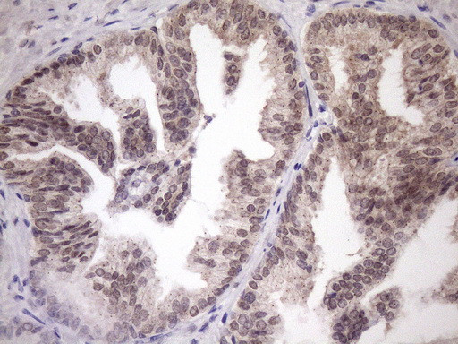 SCMH1 Antibody in Immunohistochemistry (Paraffin) (IHC (P))