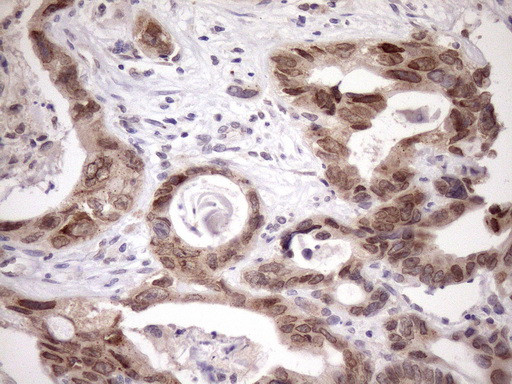 SCMH1 Antibody in Immunohistochemistry (Paraffin) (IHC (P))