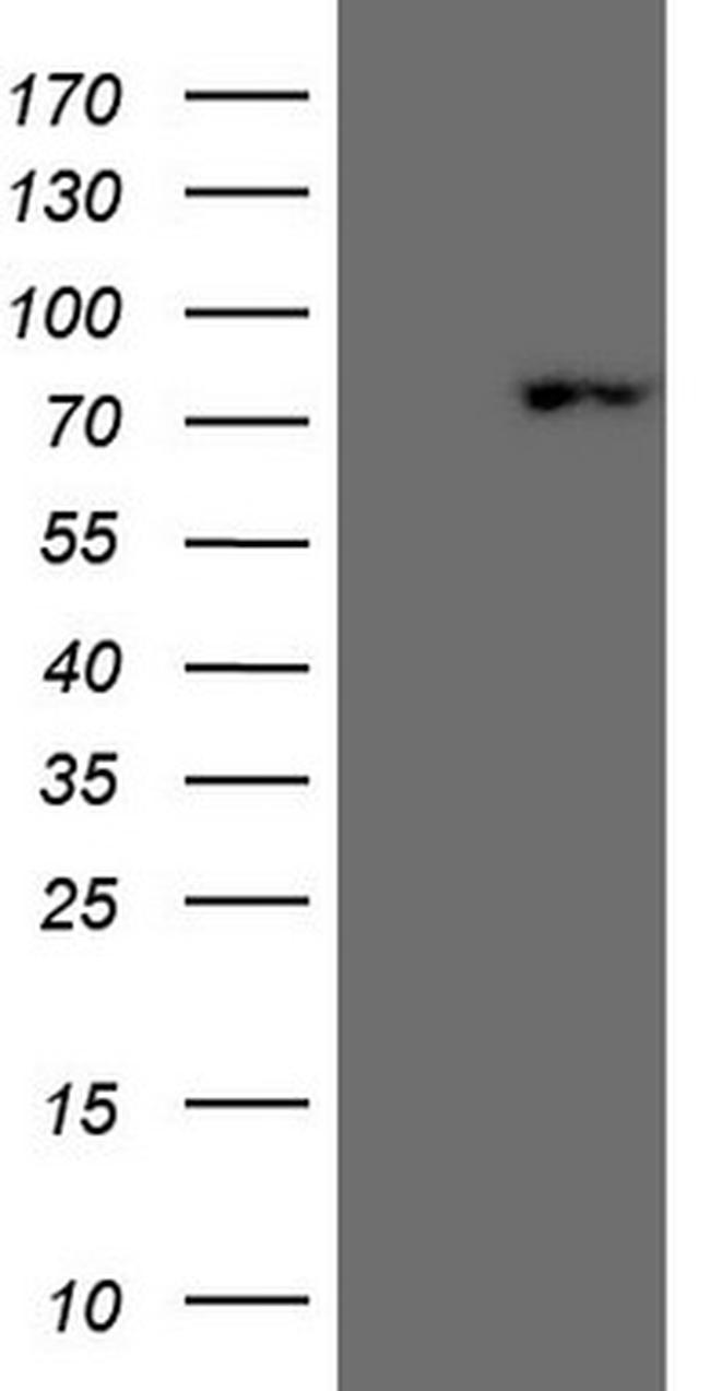 SCML2 Antibody in Western Blot (WB)