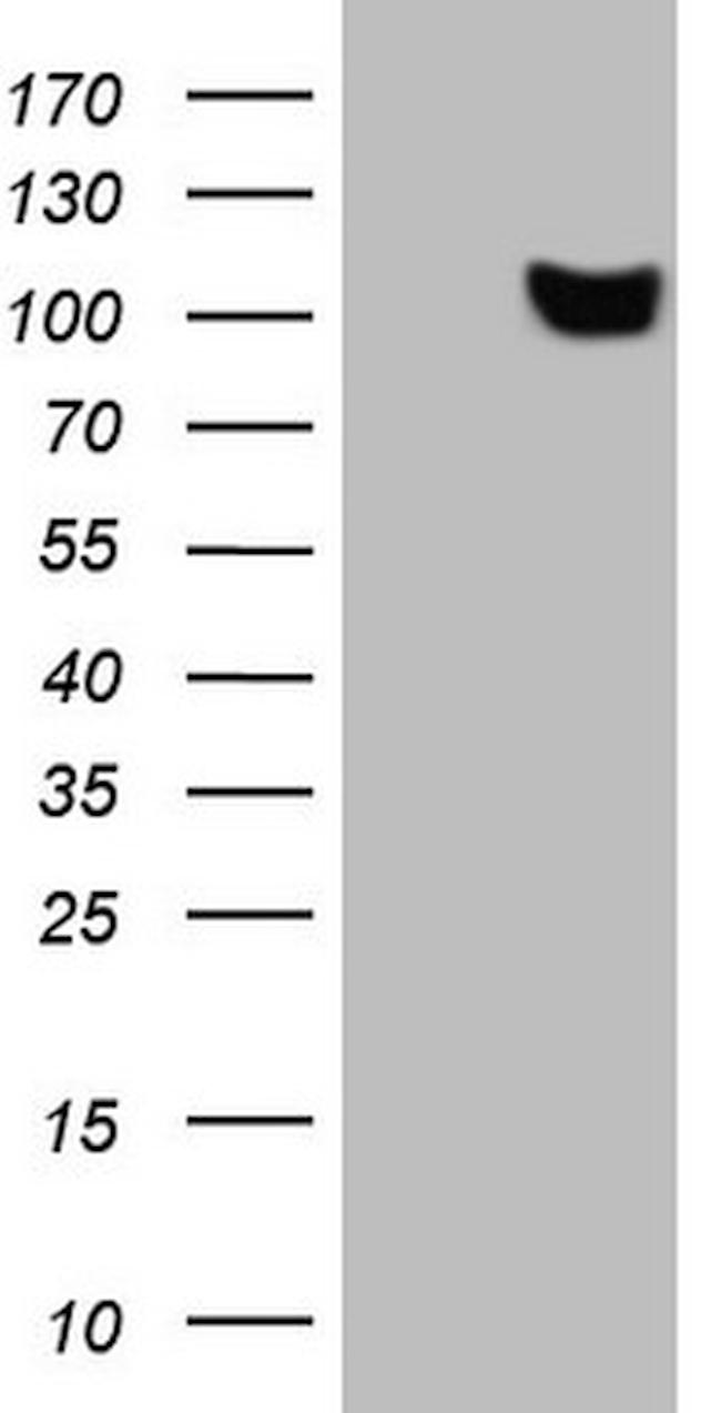 SCML2 Antibody in Western Blot (WB)