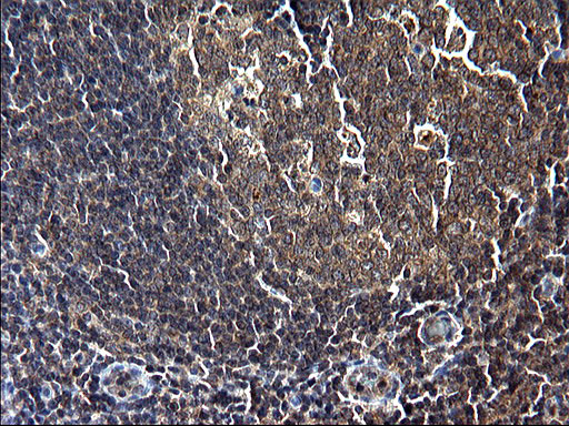 SCP2 Antibody in Immunohistochemistry (Paraffin) (IHC (P))