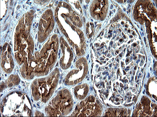 SCP2 Antibody in Immunohistochemistry (Paraffin) (IHC (P))