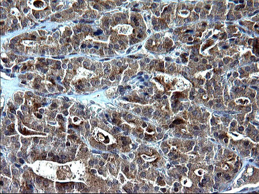 SCP2 Antibody in Immunohistochemistry (Paraffin) (IHC (P))