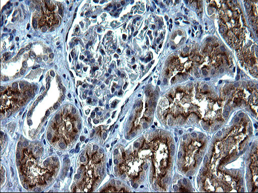 SCP2 Antibody in Immunohistochemistry (Paraffin) (IHC (P))