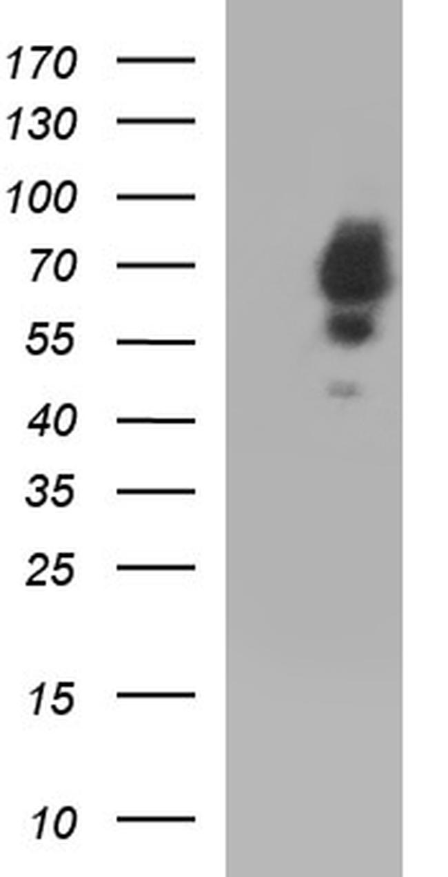 SCP2 Antibody in Western Blot (WB)