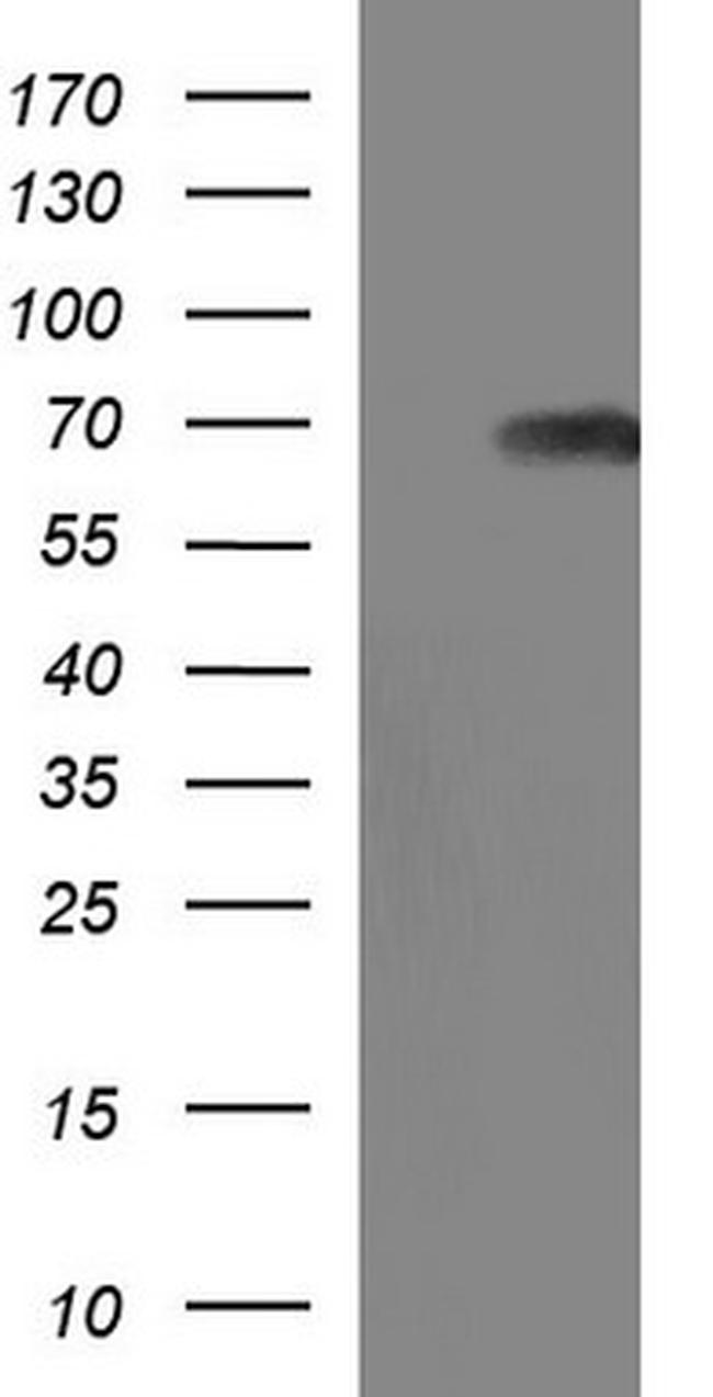 SCP2 Antibody in Western Blot (WB)