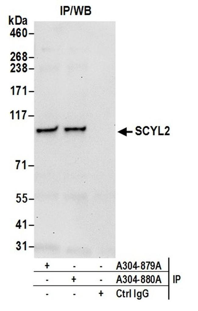 SCYL2 Antibody in Western Blot (WB)