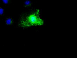 SCYL3 Antibody in Immunocytochemistry (ICC/IF)